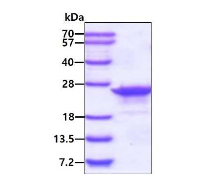 SDS-Page: Recombinant Human transgelin 2 His Protein [NBP1-51013] - 3ug by SDS-PAGE under reducing condition and visualized by coomassie blue stain.